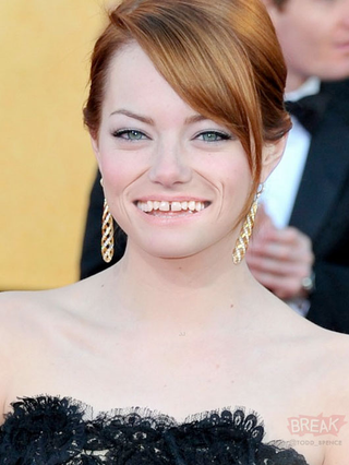 Illustration for article titled Willem Dafoe’s mouth looks bad on everybody, not just Willem Dafoe